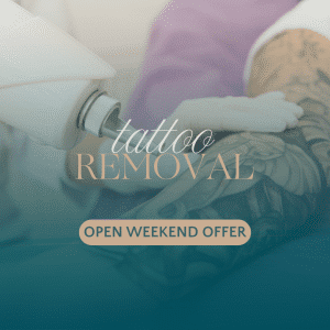 The Niumee Open Weekend - Tattoo Removal Small Offer