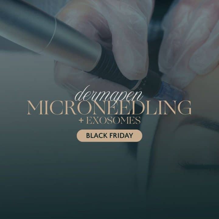 Black Friday Offer - Hair Loss Exosomes Package Of 3