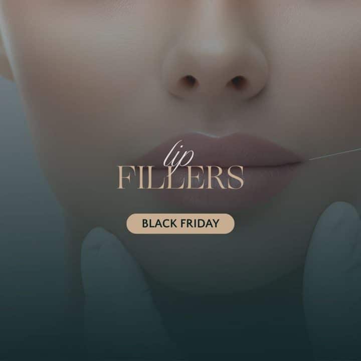 Black Friday Offer - Teosyal Ultimate 3 ml ( Cheek fillers & Jawline )